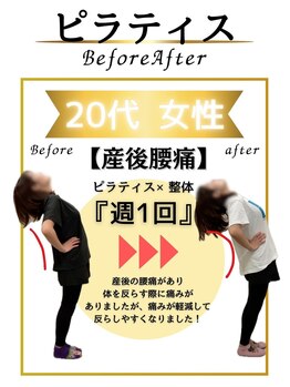 みなもと整骨院/20代　産後の腰痛