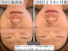 ラヴィエ ベル(La vie est belle)/ルヴィハーブ陶肌トリートメント