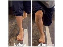 カワル整体 上通り院/扁平足の原因