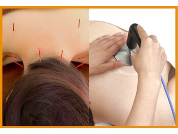 フィットジユウガオカ(Fit_Jiyugaoka)/当店人気No.1メニュー