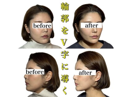 ネオオアシス トウキョウ 本町(ネオOASIS TOKYO)の写真