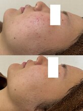 アエオボンヌール(A.E.O BONHEUR)/