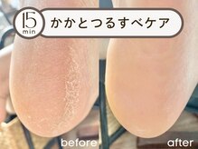 15分でここまで変わる♪ガサガサから、思わず触れたくなる足元へ