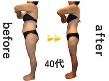 Julien千葉店【オーダーメイド痩身】ダイエット/美脚/全身痩せ/【お客様結果写真】[千葉/痩身]