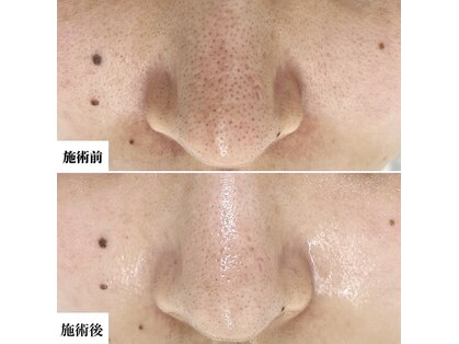 カルム(Calme)の写真