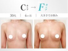 美人バスト 錦糸町店の雰囲気(育乳のプロが育ちにくい原因を徹底解明◎バストは遺伝関係無し)