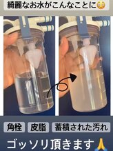 ミュー(professional beauty salon MYU)/針を使わない水光エアジェット！