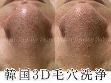 アダム 心斎橋(Adam)の雰囲気（浮き出る韓国3D毛穴洗浄★この技術は限られたサロンのみ！）