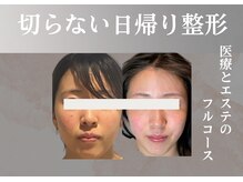 クリニカルボーテ 心斎橋院(CLINICAL BEAUTE)の雰囲気（美容家御用達サロンで若見えフェイス★エラボトサーマが大人気！）