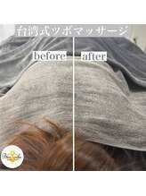 ビオエル(Bee'oele)/before after