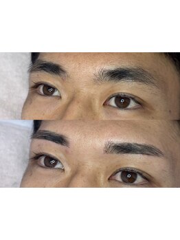 メンズフェイシャル