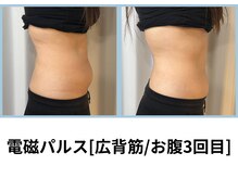 シェリール(Cherir)/電磁パルス