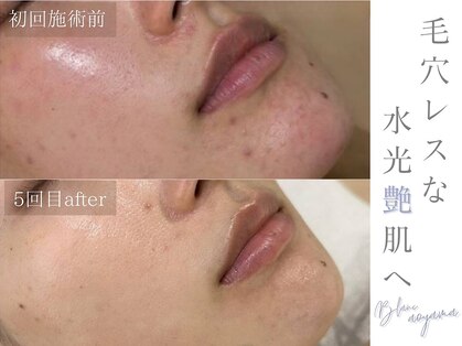 サロン ド ブラン アオヤマ(Salon de BLANC AOYAMA)の写真