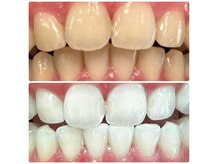 ホワイトニングルーム 横浜店(Whitening Room)の雰囲気（歯科提携のホワイトニングで驚きの白さをぜひご体感ください♪）