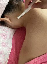 スウィートボディ(Sweetbody)/ブライダルエステ・シェービング