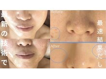 ビューティーツリー(Beauty Tree)