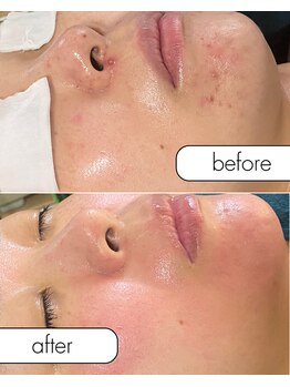 リノルーア(Linolua)/