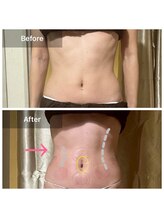 わたしのネイルとよもぎ蒸し/