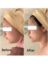 スペチアーレ 夙川/1度で劇的変化！