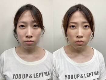 アトリエ スタンズ(atelierSTAENS)/３0代の方ビフォー＆アフター