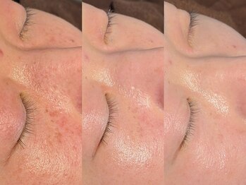 ルーナジェーナ(Luna llena)/