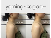 エミング(yeming)の雰囲気（美禅筋骨小顔TR(Before/after)姿勢から体を緩めて整える！）