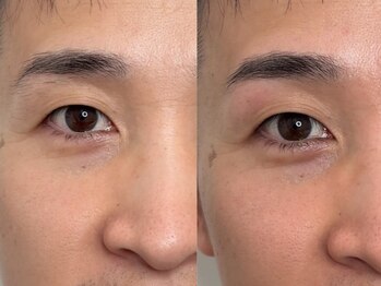 モアナ(moana)の写真/岡山でノーメイクでも美しい眉毛が叶う!一人一人の骨格、雰囲気に合わせたナチュラルな似合わせ眉をご提供!