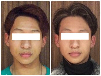 美容整体ウェリナ あま甚目寺院/小顔矯正/骨盤矯正/美脚サロン