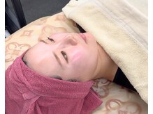 フェイスプラスリフ(FACE+RiF)/■ピーリング塗布