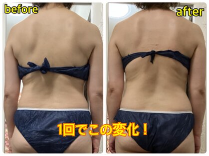 プリンセス ボディの写真