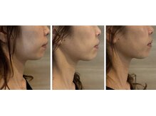 ルアナ(LUANA)/レモンボトル