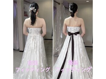 トータルボディケア サニー(TOTAL BODY CARE)/ブライダルエステbefore after