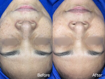 エイトスキン(8skin)の写真