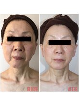 コア トータルビューティー(CORE Total Beauty)/効果写真