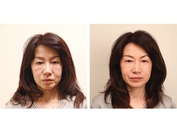 シベル(Si Belles)/ボワールリフティング/1回の結果