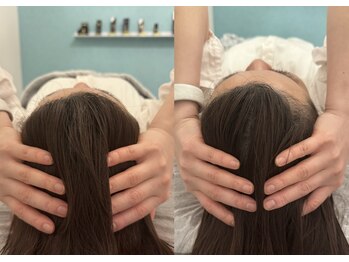 ミルジュ(MiLuJu)/ヘッドスパ/シワ改善/浮腫み解消