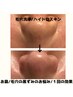 【毛穴の開き・黒ずみ徹底改善】毛穴洗浄◎ハイドロスキン60分¥12000→