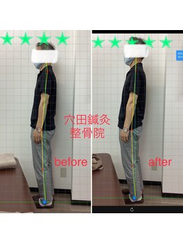 穴田鍼灸整骨院/整体・骨盤・ねこぜ・まき肩矯正