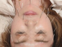 みてら鍼灸整骨院/