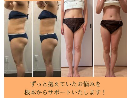 ヨサパーク エリュ 八柱店(YOSA PARK elue)の写真