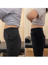 ナオ接骨院(NAO接骨院)/Before／After