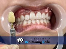 ホワイトニングカフェ 千葉店の雰囲気（お客様の症例写真はフォトギャラリーへ［千葉/ホワイトニング］）