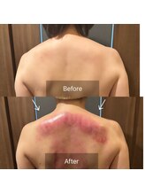 クレシア(CRECIA)/背中コルギ