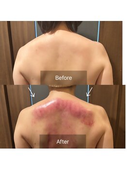 クレシア(CRECIA)/背中コルギ