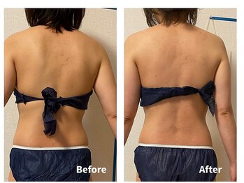 アムール(Amour)/背中のブカブカ、はみ出る事も