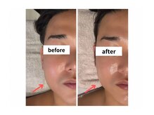 サロン シェリール(Salon Cherir)/小顔調整