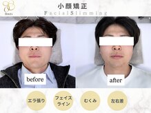 ルーツ 渋谷店(R∞ts)の雰囲気（特許庁商標登録による小顔矯正【渋谷/小顔/小顔矯正/整体/猫背】）