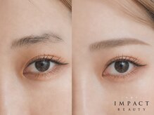 インパクト 岡山駅前サロン(IMPACT)/くすみ抜けするWAX脱毛