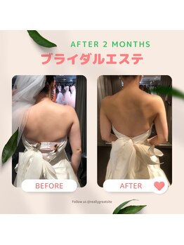 エステティックシトラス(esthetic CITRUS)/ブライダルエステ