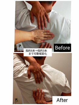 アース エンジェル整体院/ビフォアフ 整体&肩 90分